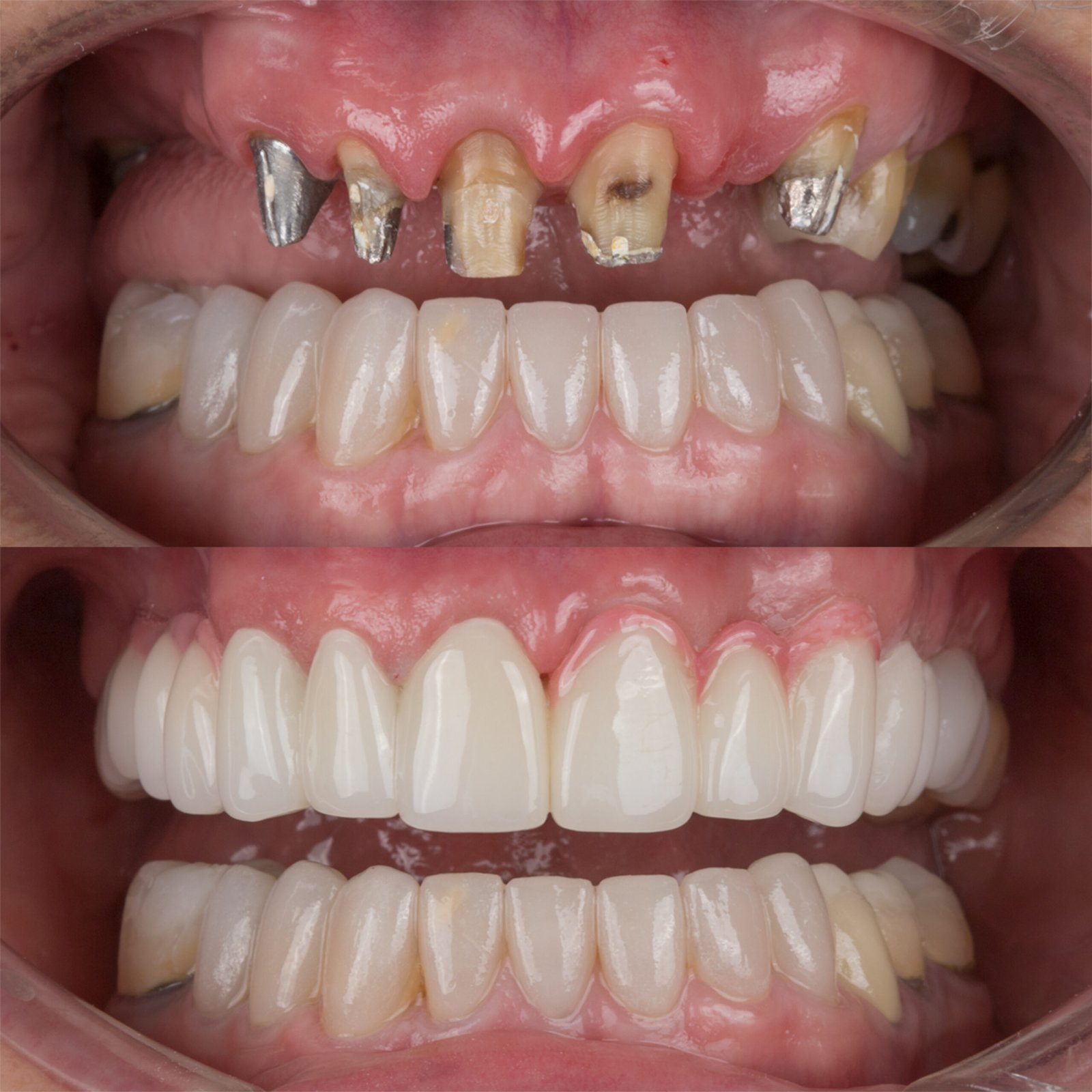 Rehabilitación Oral