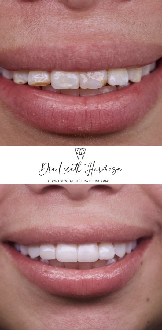 Diseño de Sonrrisa